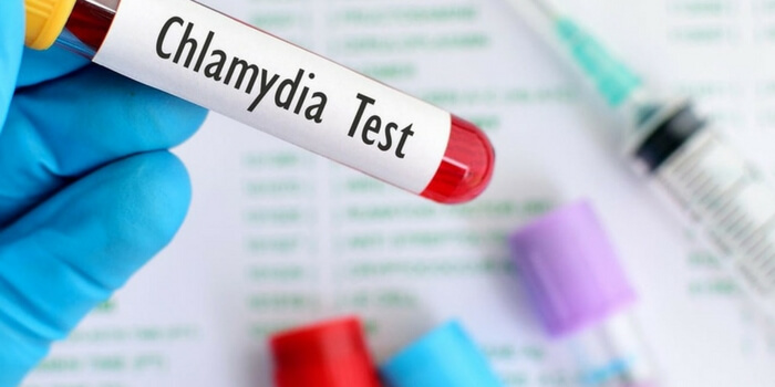 Chlamydia – ce este ea și cum o evităm